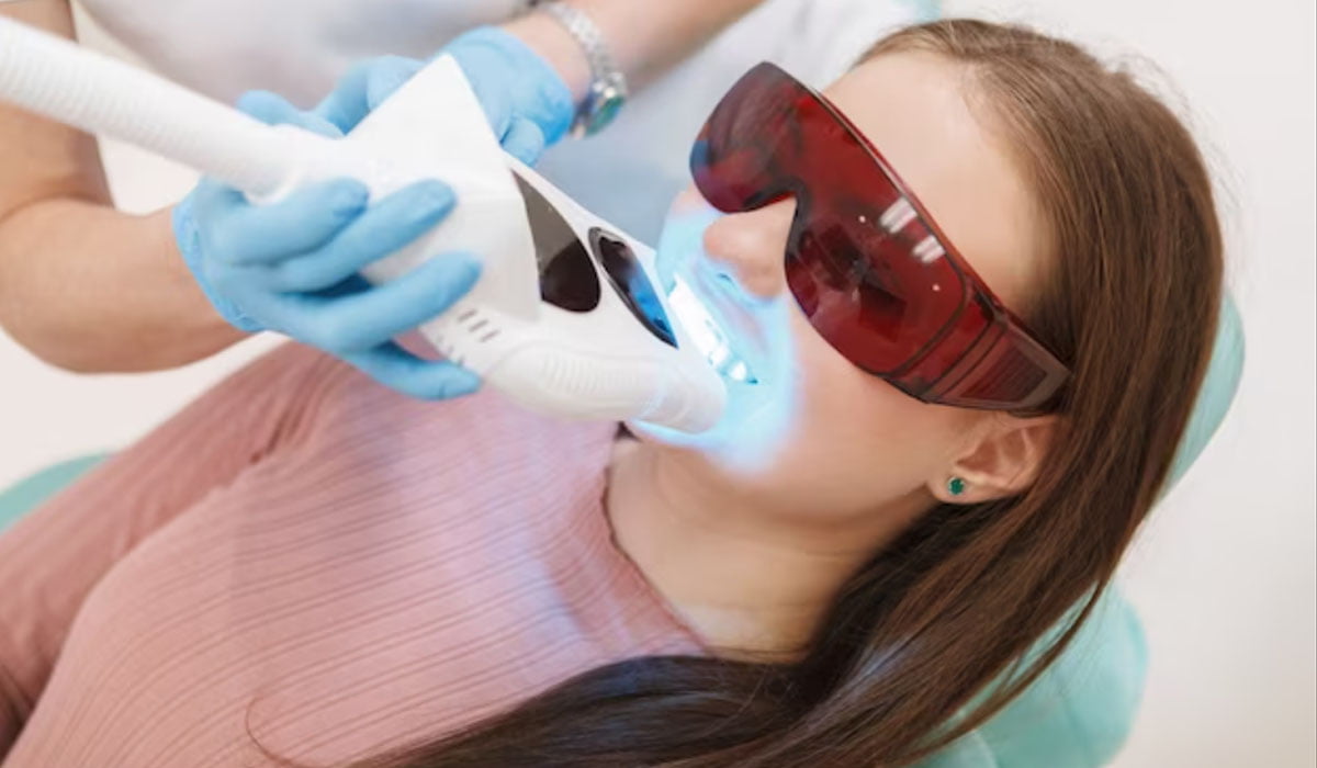 Precision, Care, and Radiance: NOVA Dental Hospital Introduces Laser Teeth Whitening with Minimal Discomfort