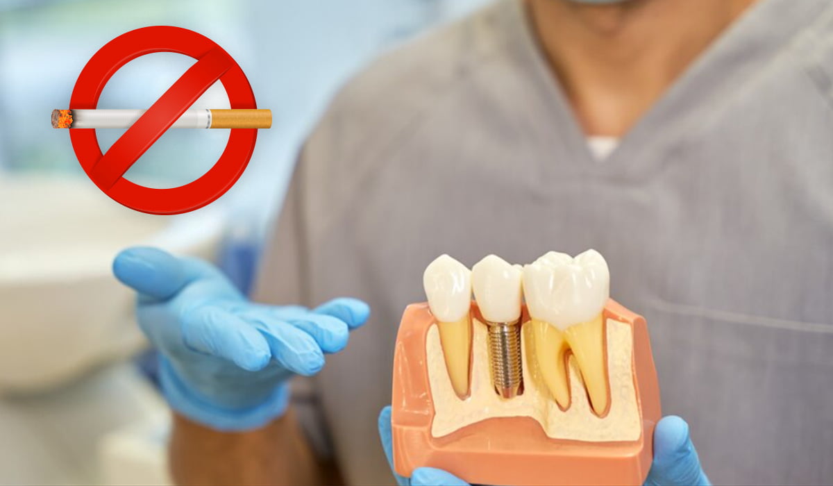 Why Smoking is a Contraindication for Implant Patients – A Closer Look at Oral Health Risks